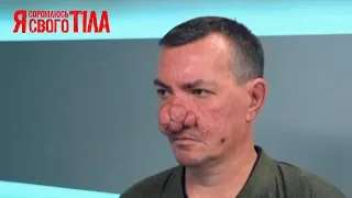 Патологии – Я стесняюсь своего тела 2019. Смотри 22 сентября на СТБ