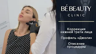 Коррекция нижней трети лица (Профиль Джоли) в BE BEAUTY CLINIC ( г. Симферополь, Крым).