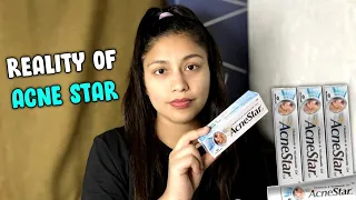 Acnestar Gel review | How to Get rid of Acne | Noni Roga