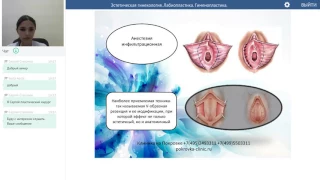 Эстетическая гинекология. Лабиопластика. Гименопластика.