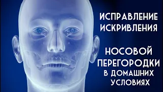 Искривление носовой перегородки и исправления ее самостоятельно. Пранаяма и кривой нос.