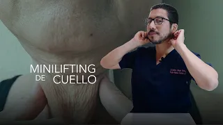 Mini Lifting de cuello o Cervicoplastia - Todo lo que tienes que saber