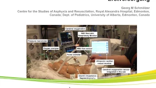 Intubation oder Larynxmaske während der Neugeborenen-Reanimation (in German)