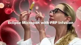 Eclipse Micropen with PRP Infusion - Pearlman Aesthetic Surgery