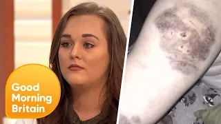 Domestic Abuse Victim Calls for Others to Speak Out | Good Morning Britain