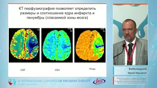 Менеджмент острого ишемического инсульта в практике врача-анестезиолога (Кобеляцкий Ю.Ю.)