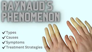 Raynaud's Phenomenon: Types, Causes, Symptoms, and Treatment Strategies