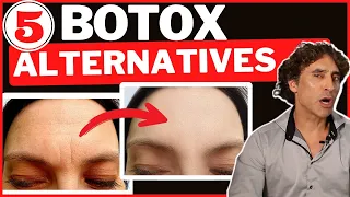 5 BOTOX ALTERNATIVES That ACTUALLY WORK!!