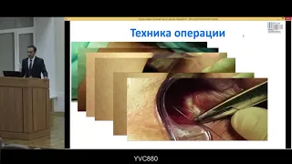 Матинян Анушаван Ваагнович. Диссертация на соискание ученой степени кандидата медицинских наук.