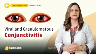 Viral and Granulomatous Conjunctivitis | Ophthalmology Lecture | V-Learning | sqadia.com