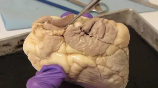 Heart Dissection: Sheep Heart  External Anatomy