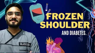 FROZEN SHOULDER/Adhesive Capsulitis|Causes|Symptoms|Relation with Diabetes|Management|Physiotherapy.