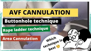 AV fistula Cannulation,needling technique/buttonhole technique/ropeladder technique/area Cannulation