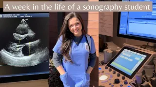 Week in the life of a Sonography Student