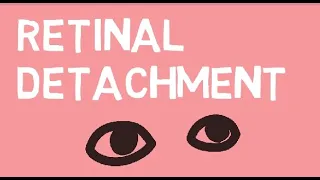 Retinal detachment