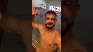 Yair Rodríguez Shows his Battle Scars After War with Max Holloway
