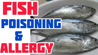 Allergy sa Isda at Food Poisoning – by Doc Liza Ong