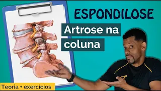 Tudo sobre Espondilose - Artrose na Coluna - Teoria + Exercícios p/ alivio e prevenção da dores