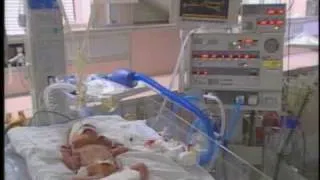 NC Receives Failing Grade In Premature Births