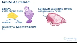 Endometrial hyperplasia (Gynecologists' Lecture)