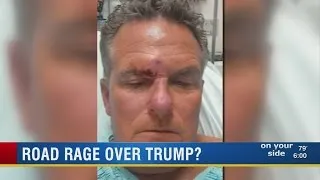 Road rage victim says he was brutally attacked for having Trump bumper sticker