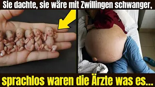 Sie dachte, sie wäre mit Zwillingen schwanger, sprachlos waren die Ärzte was es…