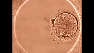 Этапы развитие эмбриона при ЭКО