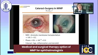 Medical and surgical therapy option of MMP for ophthalmologists - Dr Gerd Geerling