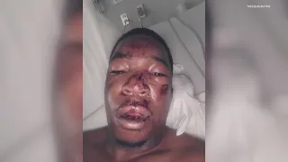 Graphic: Man who says Greensburg police beat him plans to sue