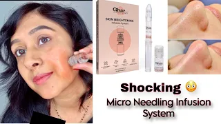 How To Use Ghar Soaps Micro Needling Infusion System At Home | Genuine Review