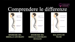 Differenze: Sindrome del midollo ancorato, Sindrome del midollo ancorato occulto e Malattia de Filum