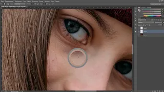 Убрать синяки под глазами в фотошопе