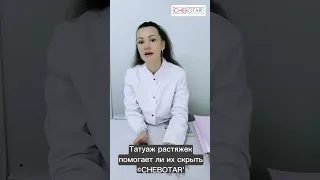 Татуаж растяжек помогает ли их скрыть... ©CHEBOTAR' - МАСКИРОВКА КАМУФЛЯЖ ТАТУАЖ РАСТЯЖЕК