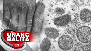 Nananatiling Global Health Emergency ang monkeypox outbreak --W.H.O. | UB