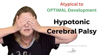 Atypical Development Baby Hypotonic Cerebral Palsy