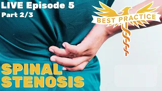 Neurosurgeon answers: Spinal stenosis, can you get better without surgery? Nope.