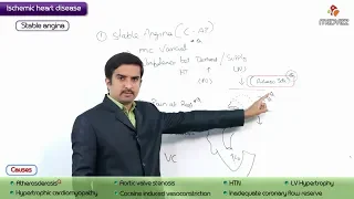 Pathology of Angina Pectoris : Stable Angina - USMLE Step 1 coronary artery disease