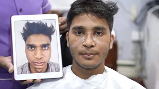 MALE NOSE JOB VLOG - From Surgery to Recovery (Rhinoplasty / Journey in India)
