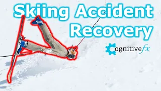 Inspiring Skiing Accident Patient Story - Jamie Crane Mauzy (TBI Treatment)