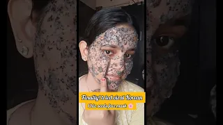 tried viral Korean Chia seeds mask | chia seeds face mask | skincare 17 #glowingskin #facemask