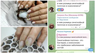 Новая клиентка с онихолизисом. Это синегнойка и грибок !