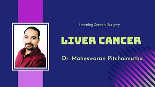 Liver Cancer : Dr  Maheswaran Pitchaimuthu