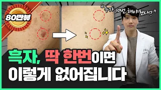 왜 레이저 10번이나 받으세요? 흑자 제거는 1번 만에 100% 치료되는데😭 힘들게 피부과 왔다 갔다 하지 마세요...