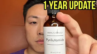 THIS IS WHAT HAPPENED AFTER TAKING PYRILUTAMIDE FOR 1 YEAR!