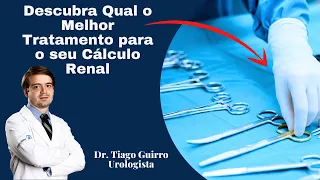 Descubra Qual o Melhor Tratamento para o seu Cálculo Renal