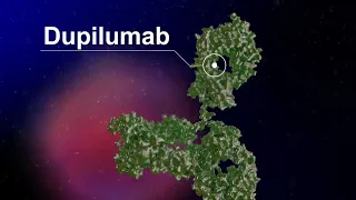 Selecting Targeted Treatment for Patients With Uncontrolled, Moderate to Severe Asthma