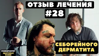 Отзыв #28 | Лечение Себорейного дерматита на лице у Павла Ястремского