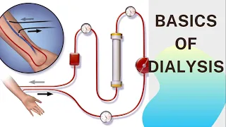 Basic concept of Dialysis Machine | Fresenius 4008S | Dialyzer & Dialysate Function