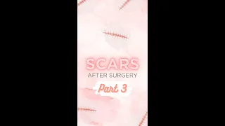 Post-Surgery Scar Management