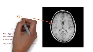 CT V/S MRI | How to Identify and Difference